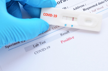 Минздрав Прикамья: Какие бывают тесты на коронавирус, как проводятся, и о чём говорят их результаты?